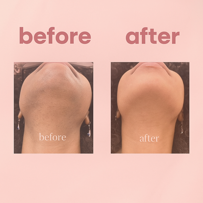 Pout-Out Lip Hair Removal Serum By ARLO
